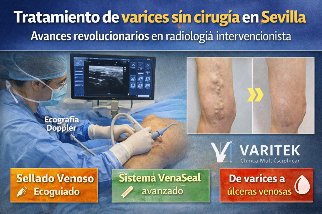 Tratamiento de varices
