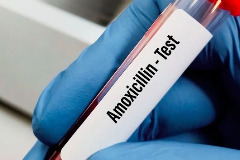 Test alergia amoxicilina Málaga logra un 100% de precisión